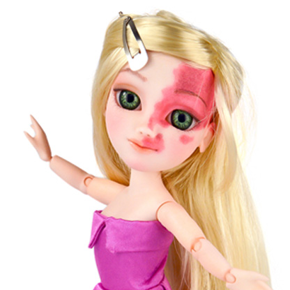 Makie doll with blonde hair, pink dress and facial birthmark over one eye and forehead.
