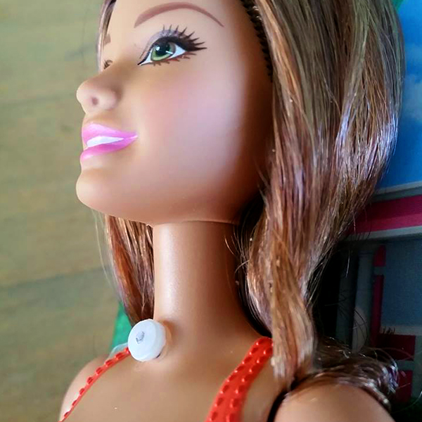 Community makeover image showing Barbie doll with trach tube.