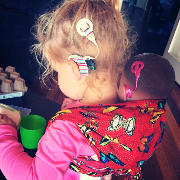 Community makeover image showing a toddler with a cochlear implant. On her back she carrying a baby doll with a matching cochlear implant.