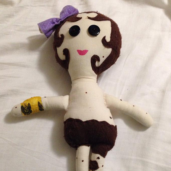 Community makeover image showing a rag doll with multiple large brown moles on it's skin.