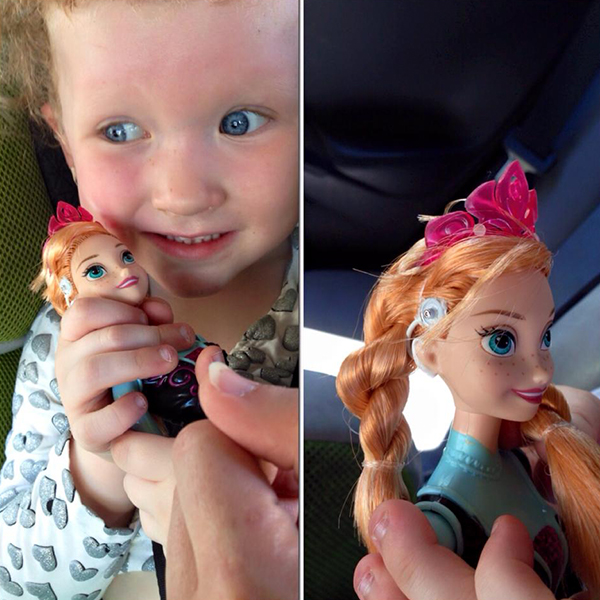 Community makeover image showing a little girl clutching an Ana doll with a model cochlear implant.