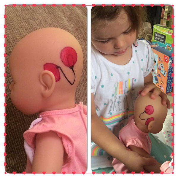 Community makeover image showing a girl and baby doll. The baby doll has a cochlear implant drawn on her head.